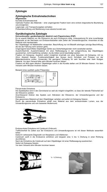 Zytologie Zytologische Entnahmetechniken ... - Labor Team W