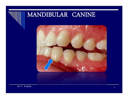 MANDIBULAR CANINE