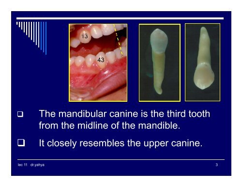 MANDIBULAR CANINE