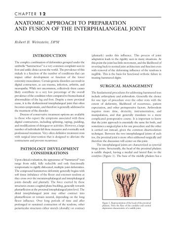 anatomic approach to preparation and fusion of the interphalangeal ...