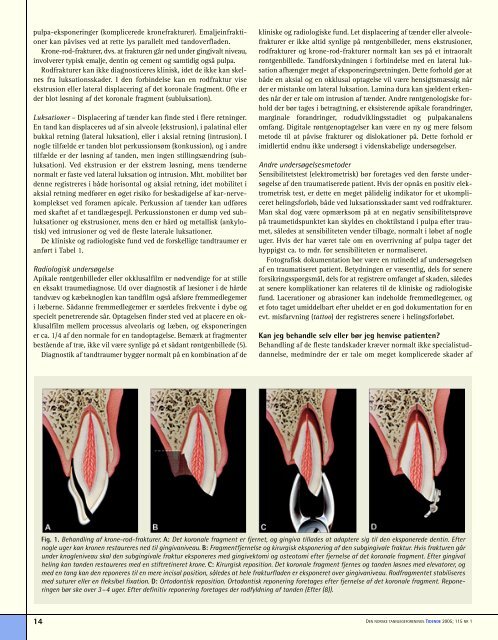 Dentale og orale skader - Den norske tannlegeforenings Tidende