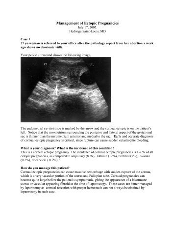 Management of Ectopic Pregnancies