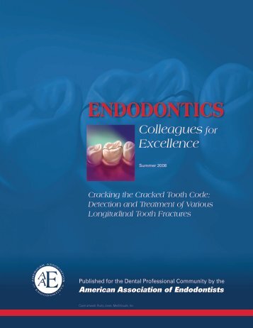 Cracking the Cracked Tooth Code - American Association of ...