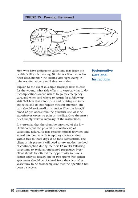 No-Scalpel Vasectomy: An Illustrated Guide for ... - EngenderHealth