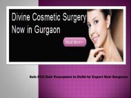 Fue Hair Transplantation Delhi