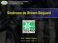 Síndrome de Brown-Sequard - Dr. Gerardo Cristino