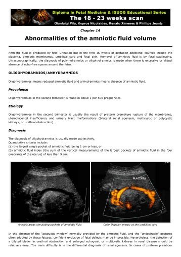 15. Abnormalities of the amniotic fluid volume