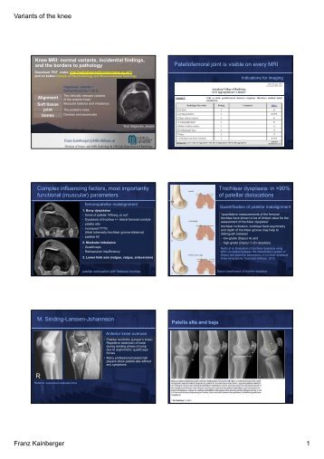 Variants of the knee Franz Kainberger 1