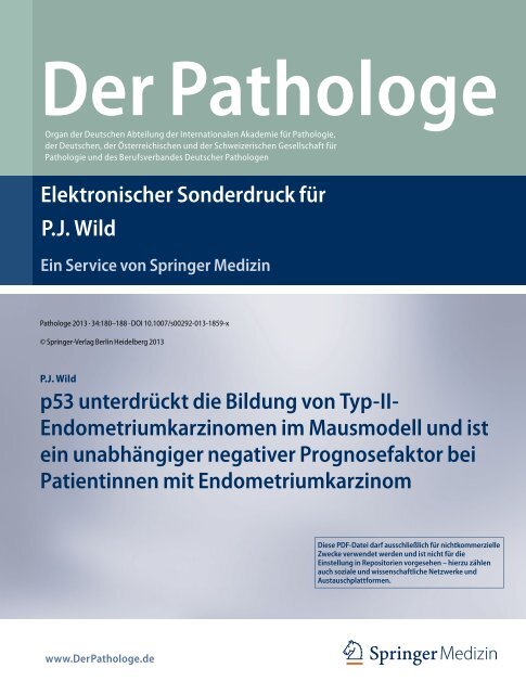 Elektronischer Sonderdruck für p53 unterdrückt die Bildung von Typ-II