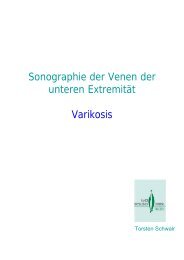 Sonographie der Venen der unteren Extremität Varikosis