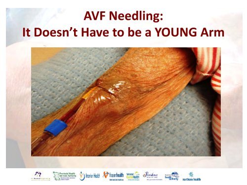 Vascular Access Module #3: AVF Maturation ... - BC Renal Agency