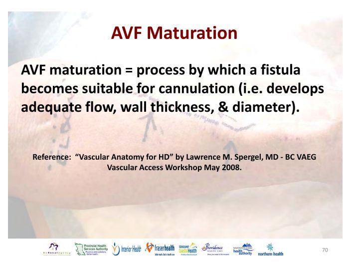 AVF