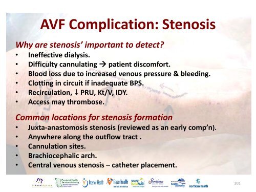 Vascular Access Module #3: AVF Maturation ... - BC Renal Agency