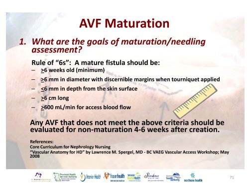 Vascular Access Module #3: AVF Maturation ... - BC Renal Agency