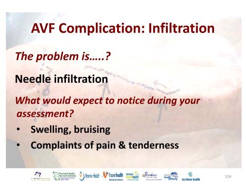 Vascular Access Module #3: AVF Maturation ... - BC Renal Agency