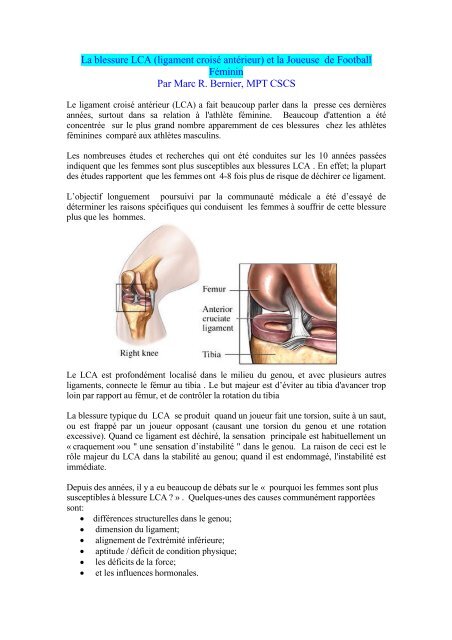 le ligament croisé dans le foot feminin