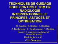 techniques de guidage sous contrôle tdm en radiologie ...