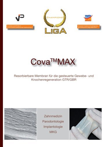 Cova Max - Champions-Implants