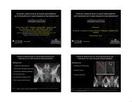 Anatomic determinants of sacral dysmorphism and implications for ...