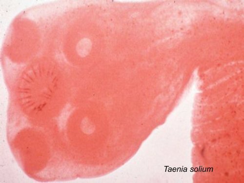 Neglected Tropical Diseases - UT Southwestern