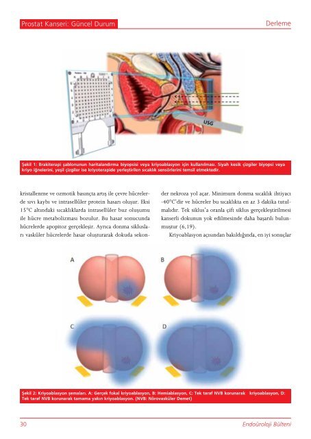 Prostat anatomisi: yeni konseptler - Endouroloji Derneği