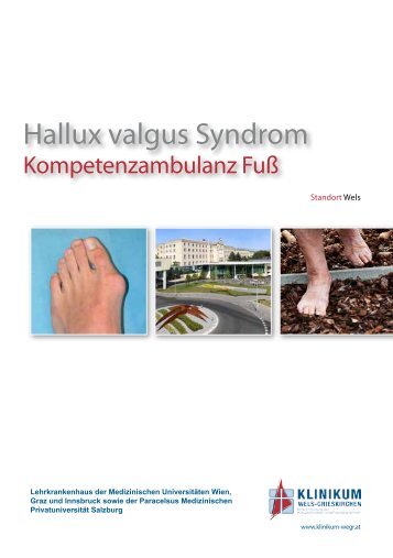 Hallux valgus Syndrom - Klinikum Wels-Grieskirchen