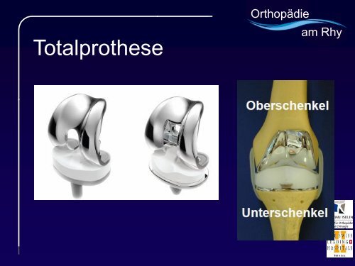 Dr. Carsten Helfrich - Hüft- und Kniearthrose - Merian Iselin Virtuell