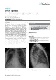 Barium aspiration - BMJ Case Reports