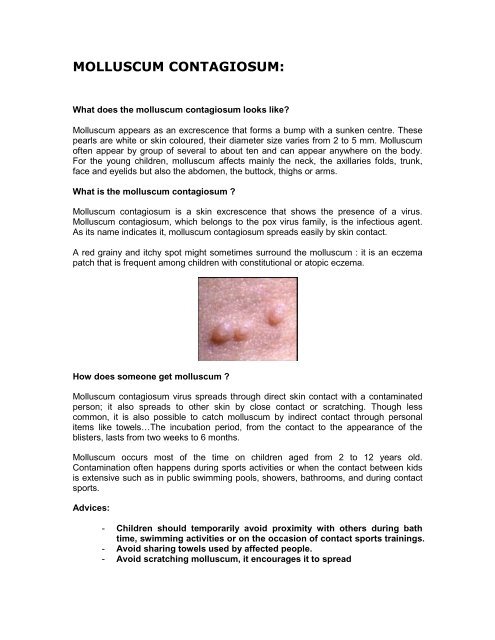 What does the molluscum contagiosum look like