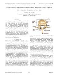 An Automated Vertebra Identification and Segmentation in CT images