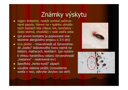 (Microsoft PowerPoint - Plo\232tica poste\276n\341-na ... - RUVZ BA
