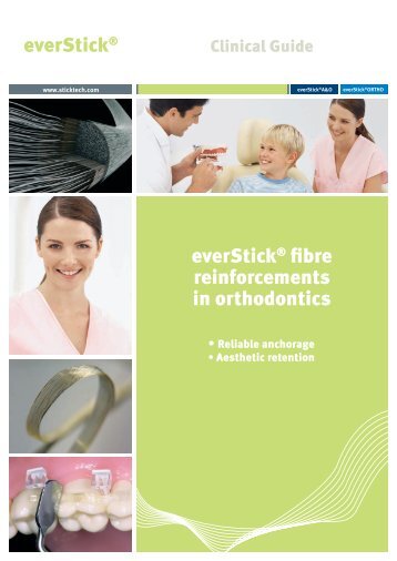 everStick® fibre reinforcements in orthodontics everStick® - StickTech