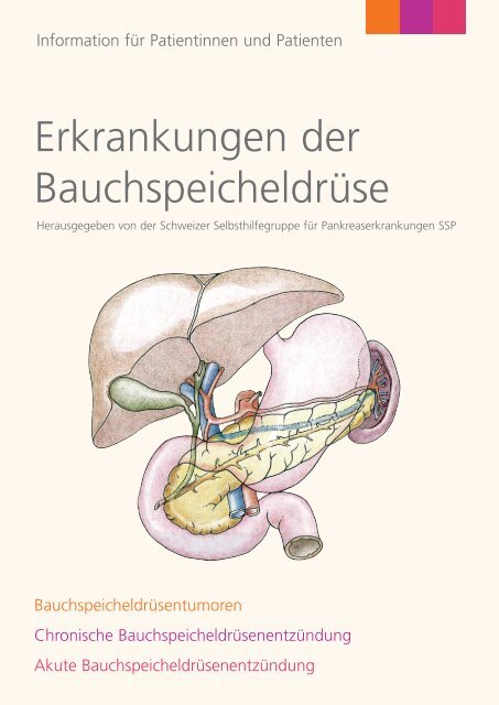 Erkrankungen der Bauchspeicheldrüse - Schweizer ...