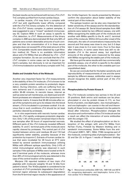 Biochemical Factors Influencing Measurement of Cardiac Troponin I ...