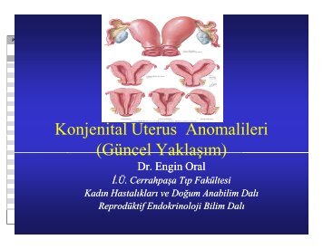 Engin Oral_Konjenital uterus anomalileri.ppt [Uyumluluk Modu]