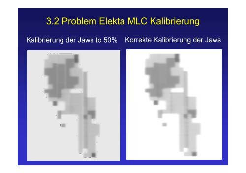 Probleme bei verschiedenen IMRT - Systemkonfigurationen