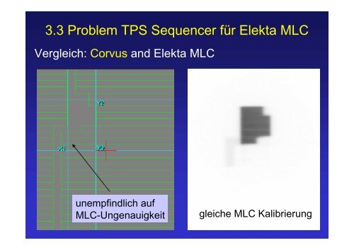 Probleme bei verschiedenen IMRT - Systemkonfigurationen