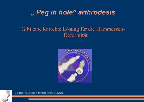 „ Peg in hole” Arthrodese - ortopediaszombathely.hu