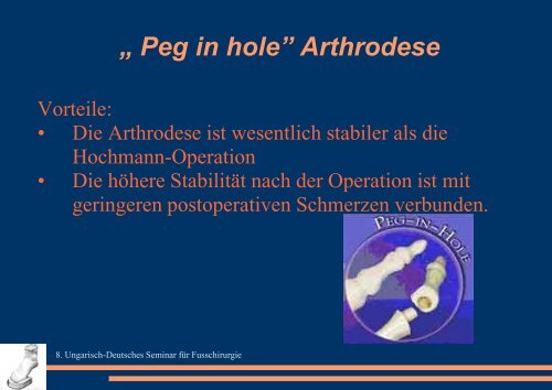 „ Peg in hole” Arthrodese - ortopediaszombathely.hu