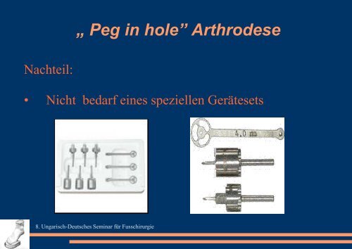 „ Peg in hole” Arthrodese - ortopediaszombathely.hu