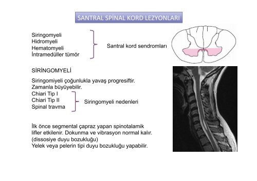 medulla spinalis