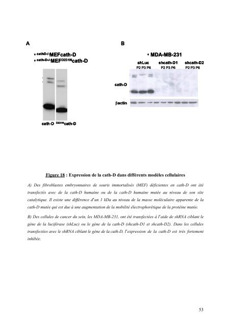 Cancer du sein et micro-environnement tumoral: rôle de la protéase ...