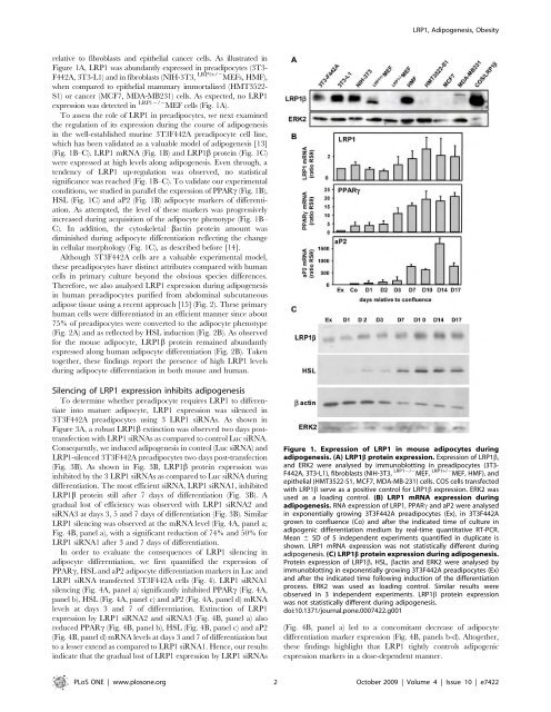 Cancer du sein et micro-environnement tumoral: rôle de la protéase ...