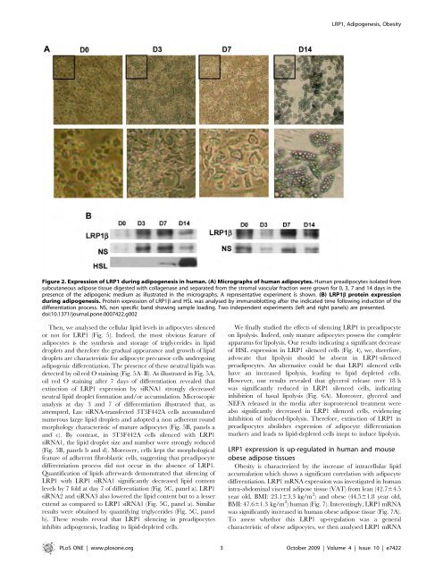 Cancer du sein et micro-environnement tumoral: rôle de la protéase ...