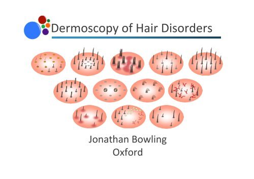 Dermoscopy of Hair Disorders notes