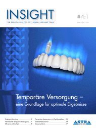 Temporäre Versorgung – - Astra Tech