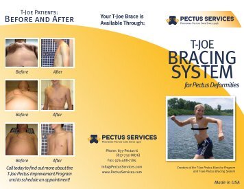 Our Brochure - Pectus Services, LLC