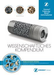 Wissenschaftliches Kompendium Zimmer® Trabecular Metal ...
