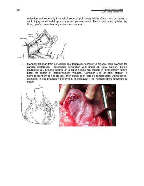 Trauma Guideline Manual - SUNY Upstate Medical University