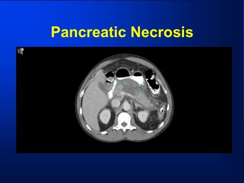 Staging Laparoscopy with Laparoscopic Ultrasonography ...